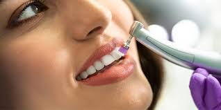 Get 50% OFF on Scaling and Polishing Treatment in Lahore